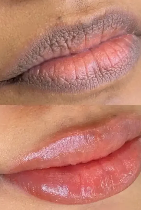 Lip Blush & Neutralisation