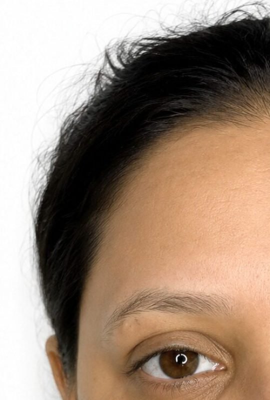 Eyebrow Transformation